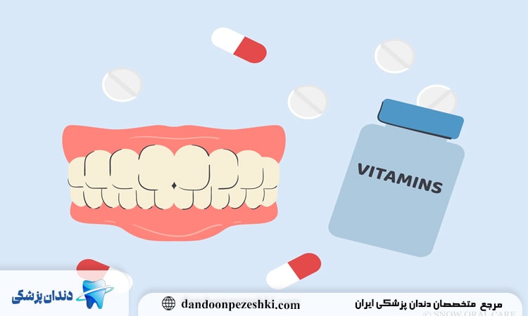 کمبود کدام ویتامین باعث پوسیدگی دندان می‌شود؟