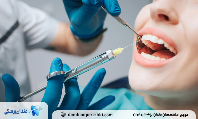 امپول بی حسی دندان