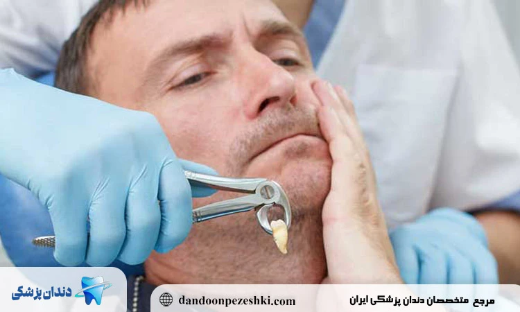 مراقبت های بعد از جراحی دندان عقل