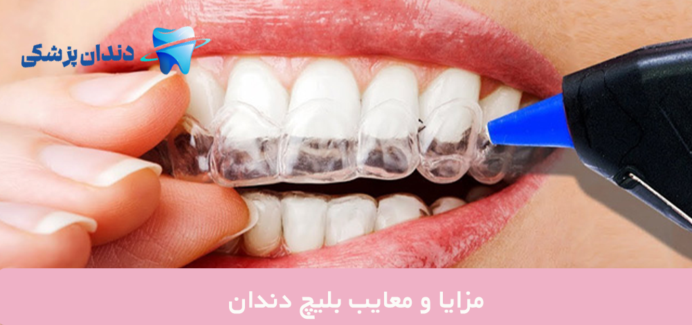 مزایا و معایب بلیچ دندان