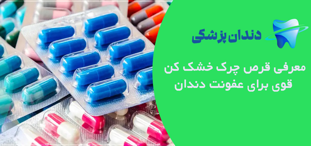 معرفی قرص چرک خشک کن قوی برای عفونت دندان