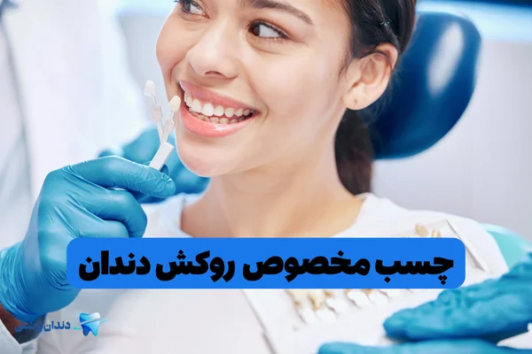 چسب مخصوص روکش دندان