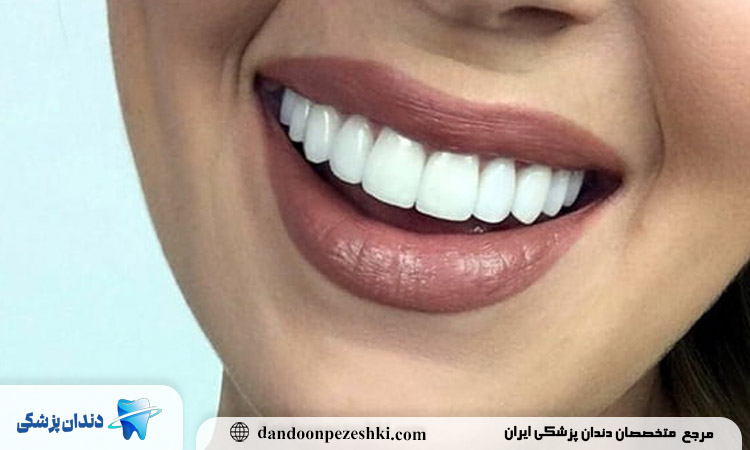 تغذیه مناسب و نقش آن در حفظ دوام کامپوزیت دندان