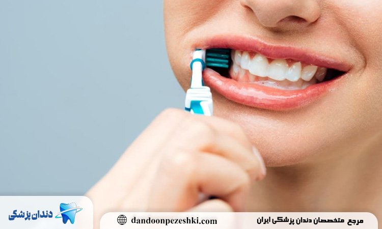 مراقبت بعد از جرم گیری دندان شامل چه مواردی می‌شود؟