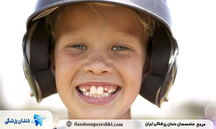 معرفی انواع روش‌های ارتودنسی مورد استفاده برای اصلاح دندان خرگوشی در کودکان و بزرگسالان