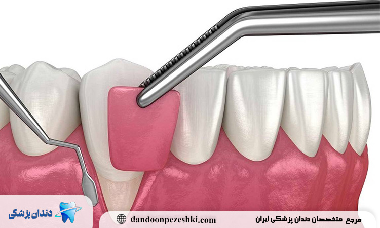نقش آسیب‌شناس در تیم درمانی