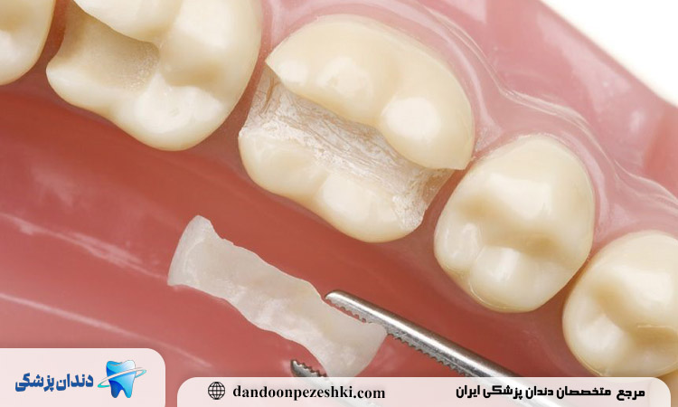 چرا انتخاب بهترین دکتر ترمیمی و زیبایی دندان اهمیت دارد؟