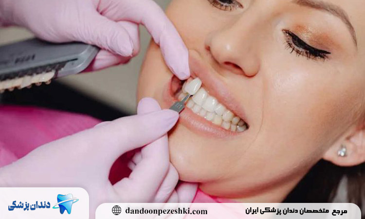 چرا انتخاب بهترین دکتر لمینت دندان اهمیت دارد؟