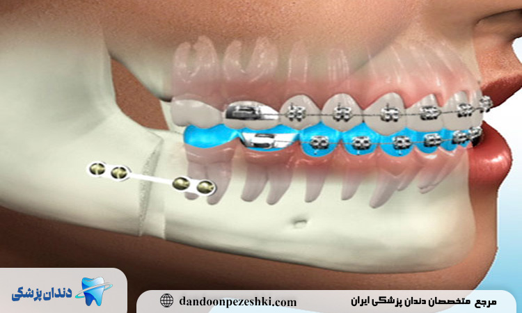 چه زمانی باید به جراح دهان، فک و صورت مراجعه کنیم؟