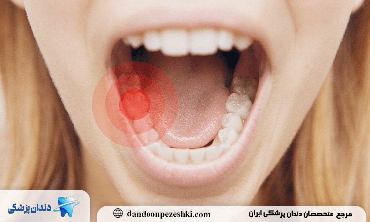 چه زمانی باید به متخصص آسیب‌شناسی دهان و فک مراجعه کنیم؟