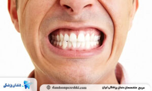 راهکارهای درمانی برای کنترل و توقف دندانقروچه شبانه