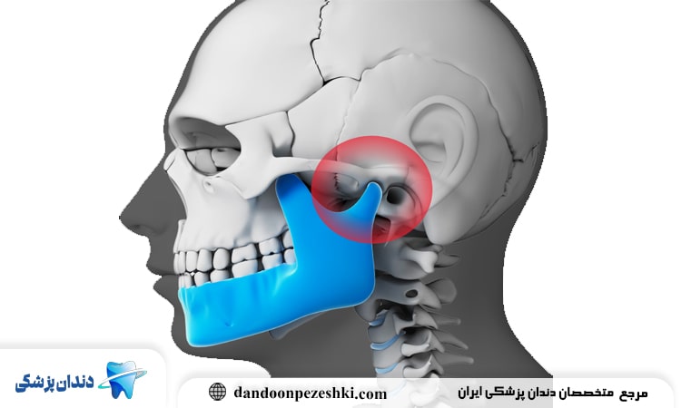 ارتباط بین دندان درد و گوش درد چیست