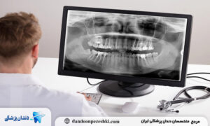 سی تی اسکن در رادیولوژی دهان، فک و صورت