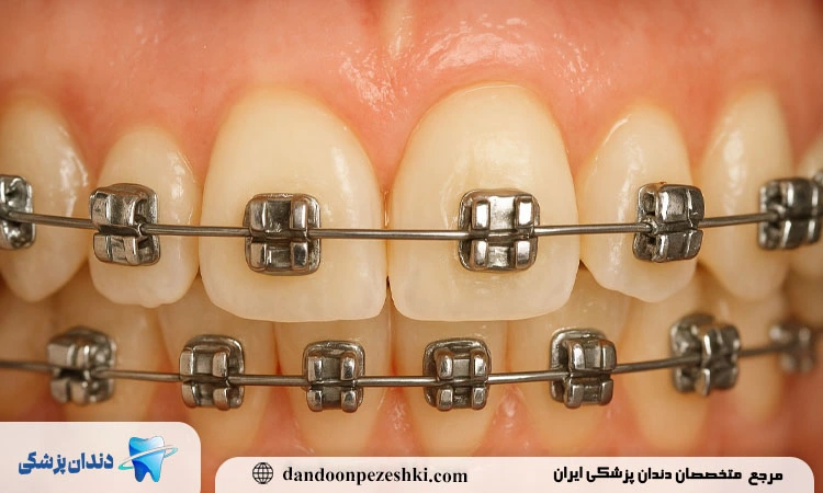 ارتودنسی اشتباه چیست