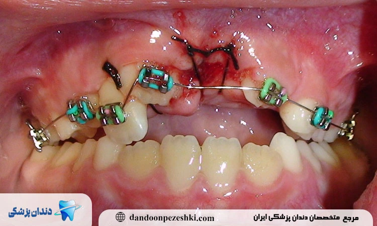 علائم ارتودنسی غلط