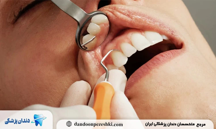 مراجعه منظم به دندانپزشک