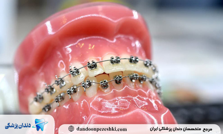 بهترین دندانپزشک ارتودنسی در بلوار فردوس