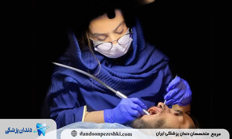انتخاب دکتر ایمپلنت در پونک