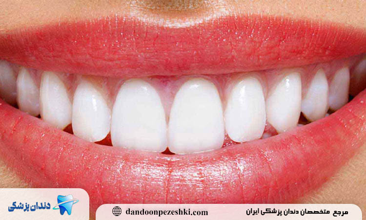 انتخاب دکتر کامپوزیت در کرج