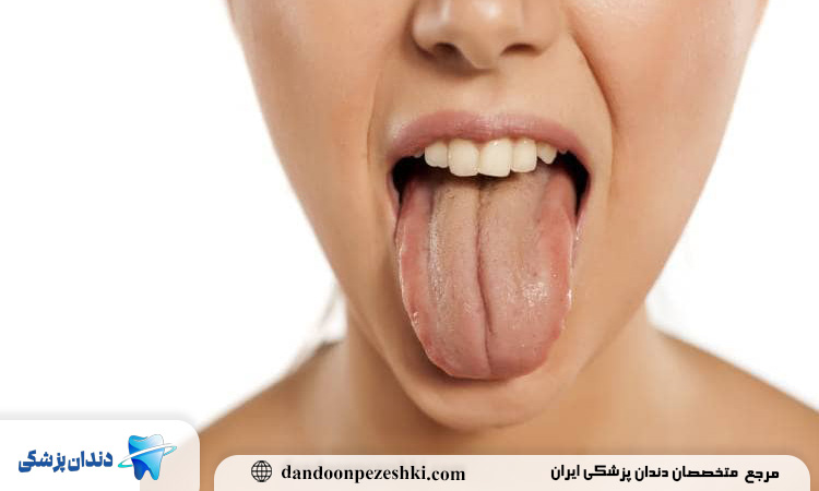 بیماری های دهان و دندان