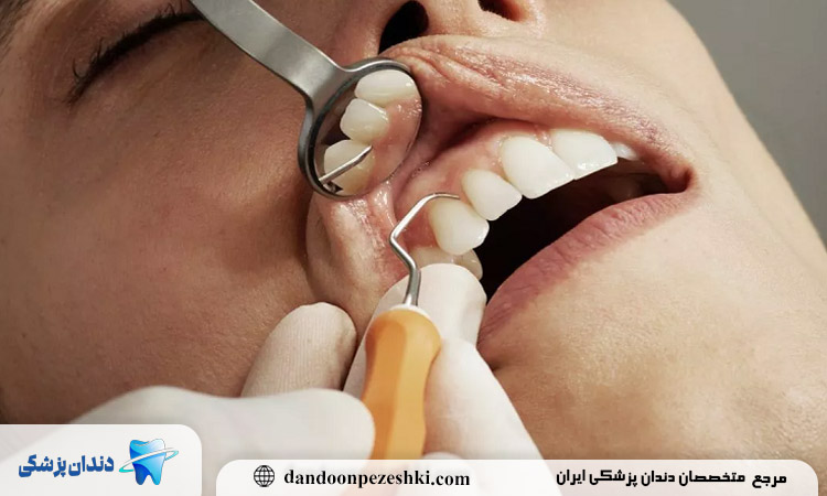 درمان بیماری های دهان و دندان