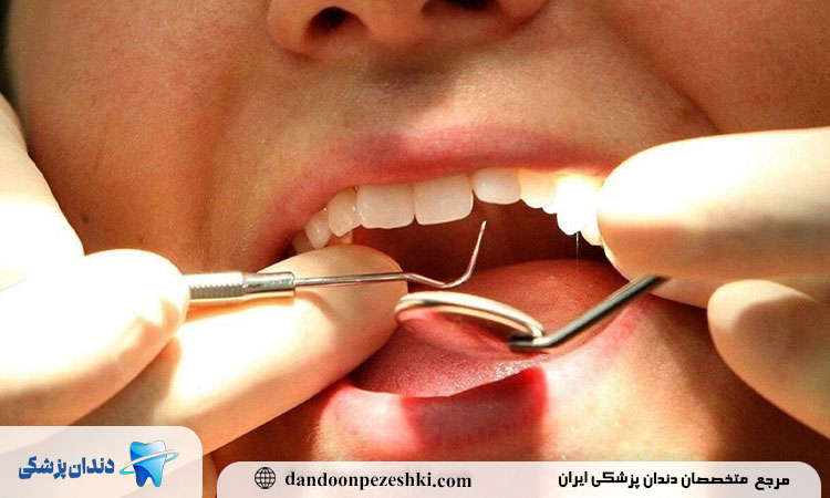  بیماری های دهان و دندان