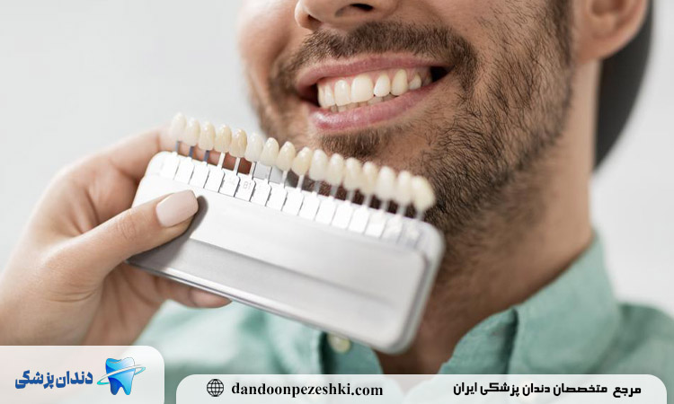  کامپوزیت در کرج