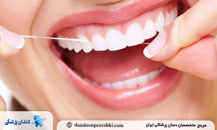 استفاده از نخ دندان