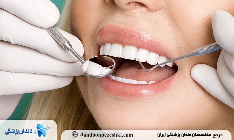 سیگار بر سلامت دندان و لثه