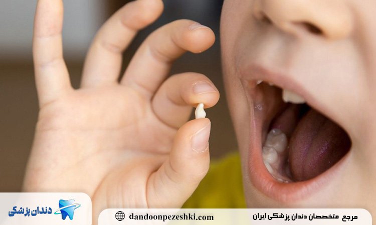 علت ریزش دندان چیست؟