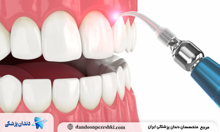 چگونگی جراحی لثه