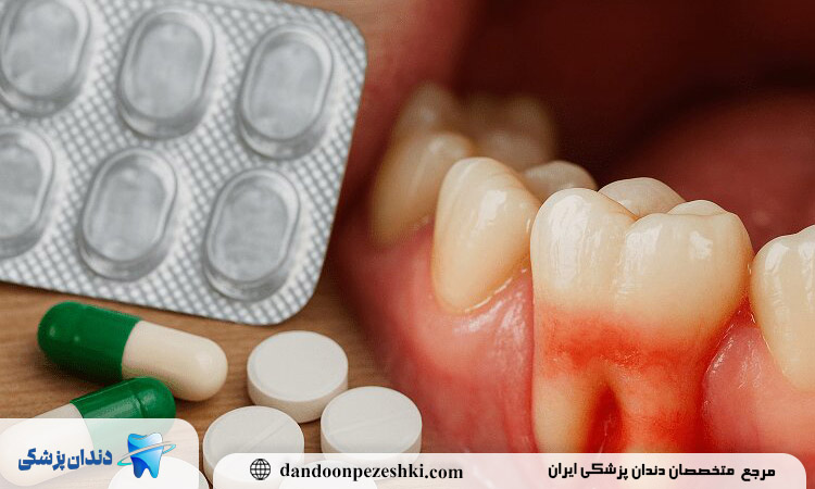 راه حل عفونت دندان