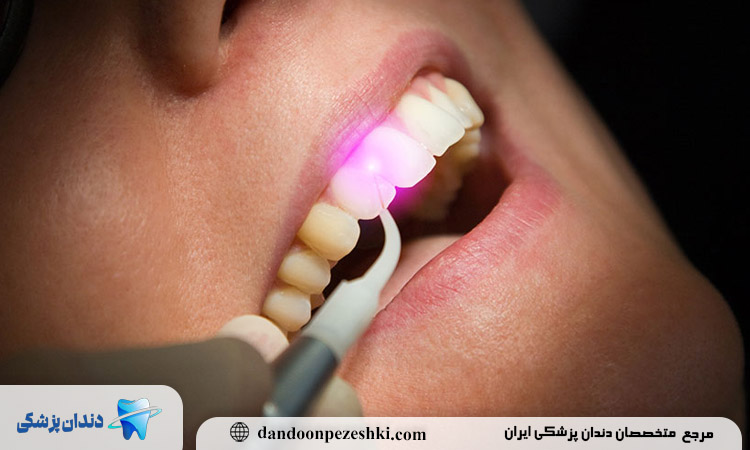 جراحی لثه چیست؟