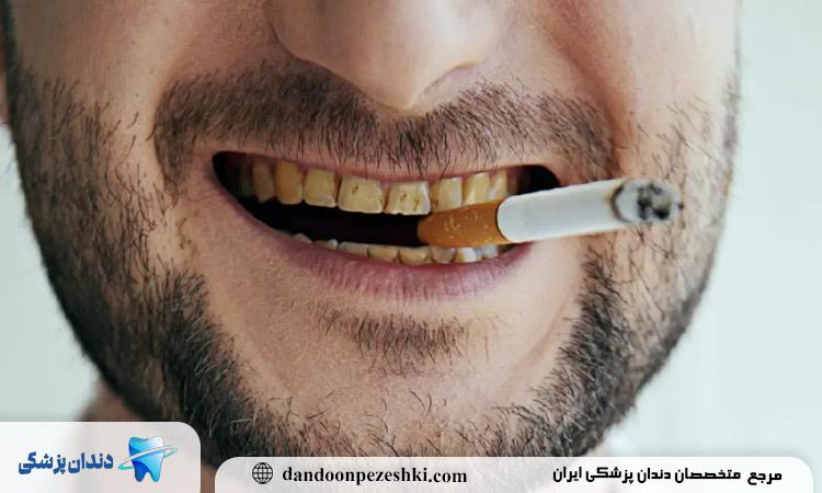 تاثیر سیگار بر سلامت دندان و لثه