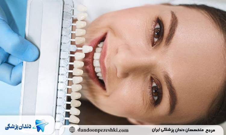 دکتر کامپوزیت در کرج