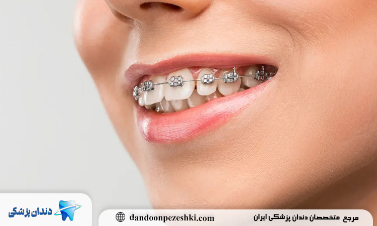 ارتودنسی در فرمانیه