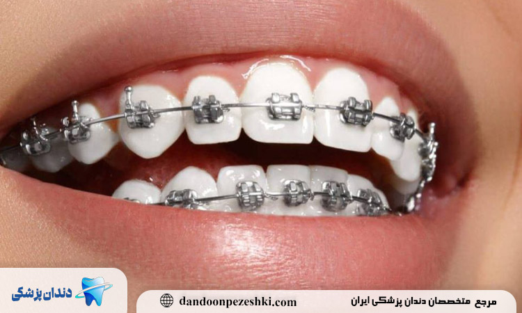 متخصص زیبایی در ارتودنسی 