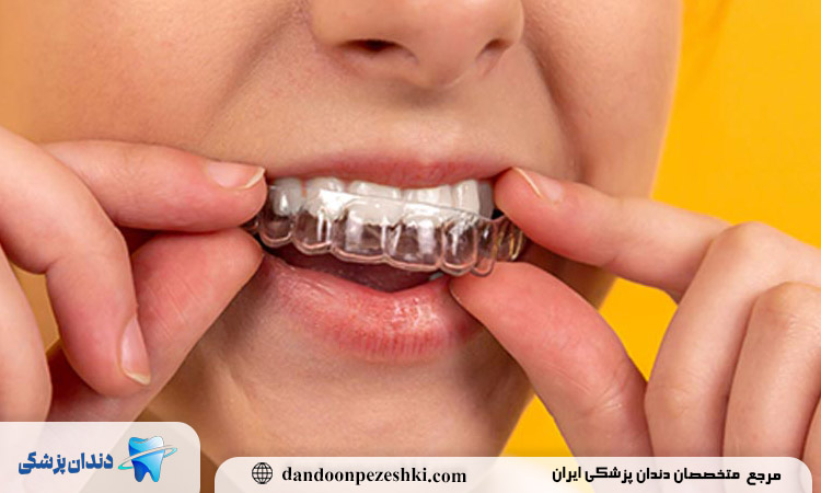 صاف کردن دندانها