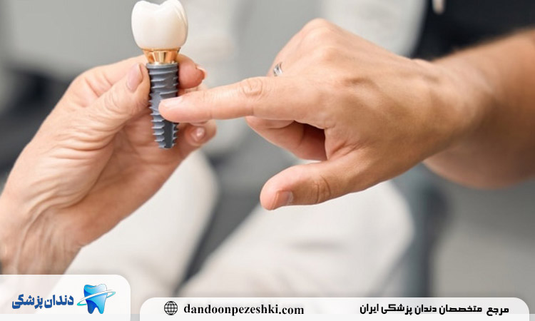 خطر ایمپلنت دندان