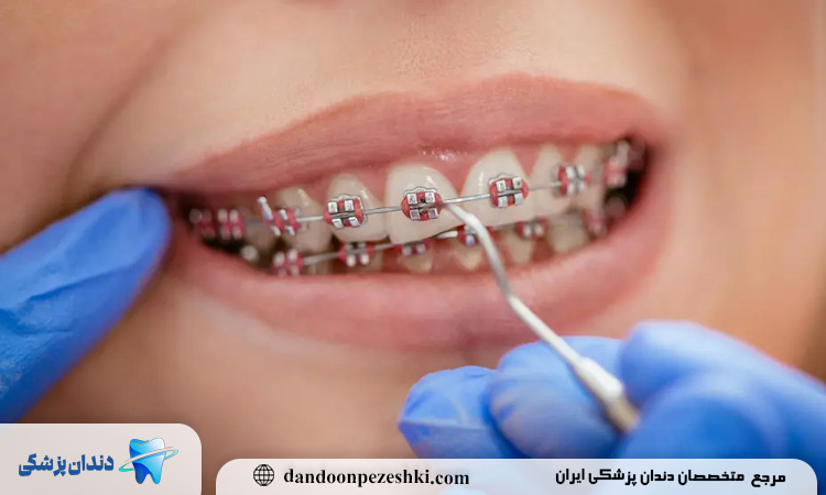 دکتر ارتودنسی در فرمانیه