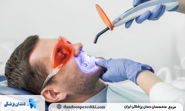 بلیچینگ چیست