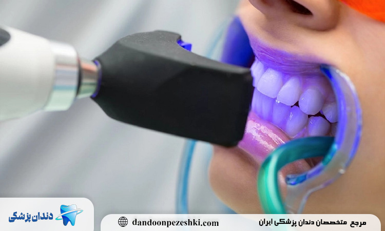 بلیچ انجام دهیم یا نه؟