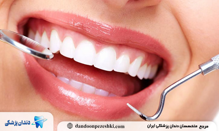 کامپوزیت دندان برای اصلاح طرح لبخند