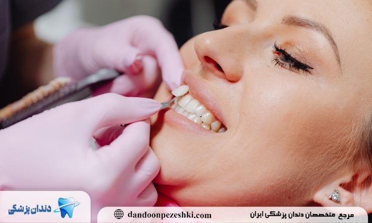 فاصله بین عصب کشی و روکش دندان