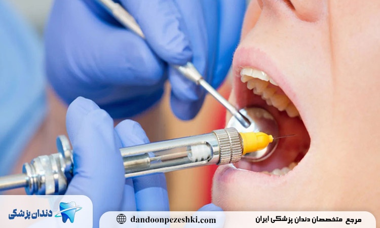 بی حسی دندان