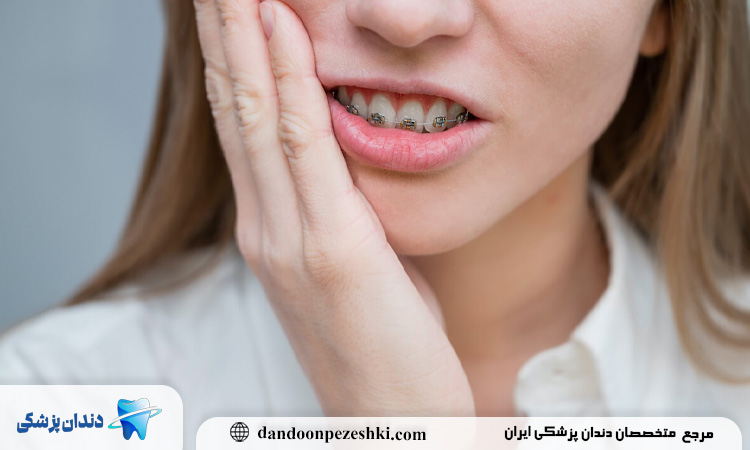 حساسیت دندان