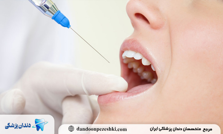 بی حسی دندان