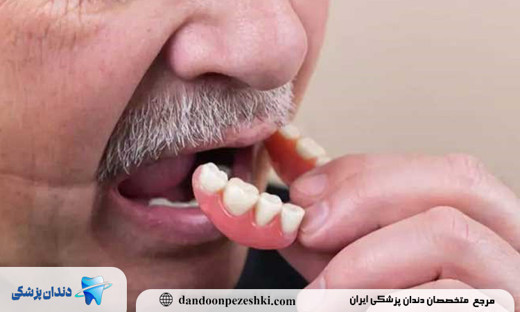  استفاده از دندان مصنوعی