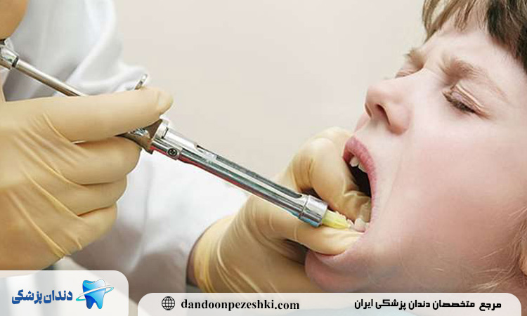 علائم عوارض آمپول بی حسی دندان چیست؟