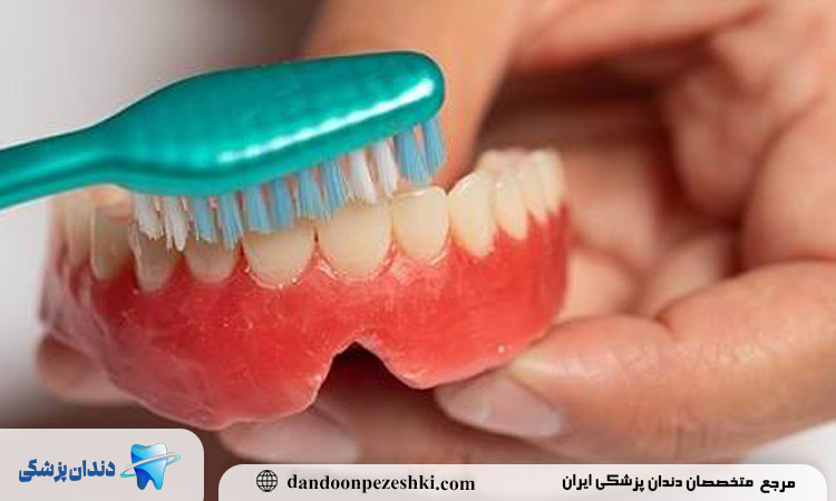 مراقبت از دندان مصنوعی